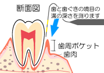 ポケット検査